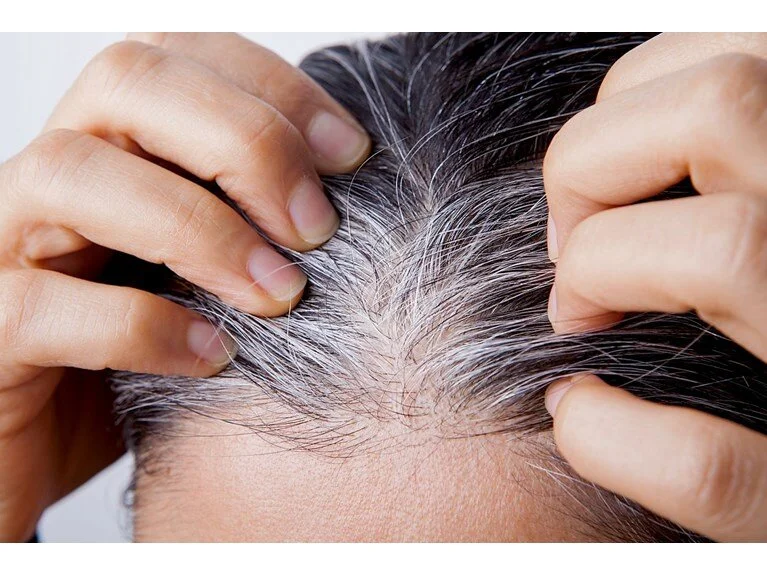 Saçlarınız beyazlıyorsa dikkat edilmesi gerekiyor